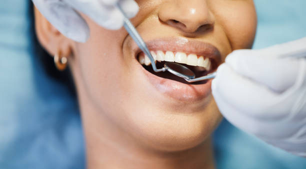 Best Emergency Dental Care for Trauma or Injury in Perryman, MD